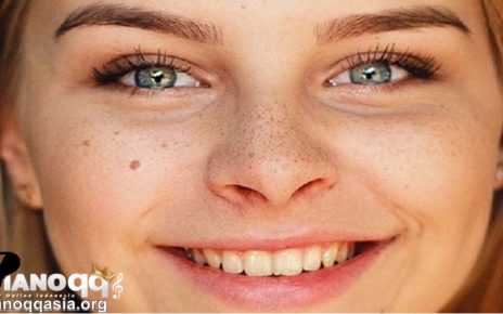Beberapa Faktor Penyebab Flek Hitam pada Wajah