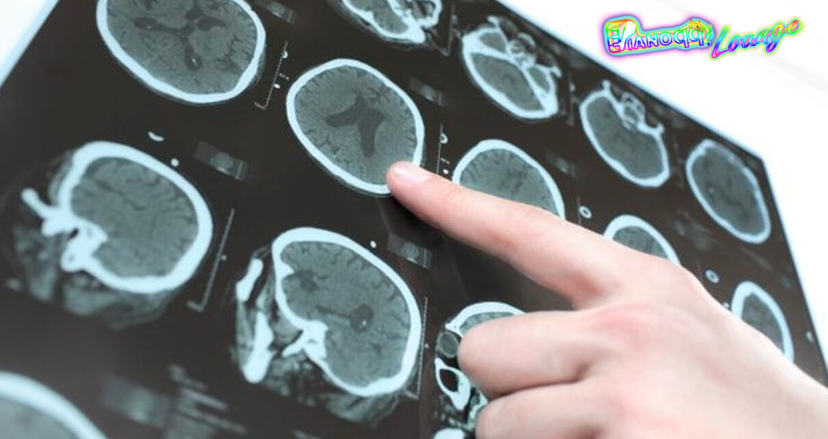 Migrain Bertahun-tahun, Ternyata Ada Cacing Pita di Otak Wanita Ini